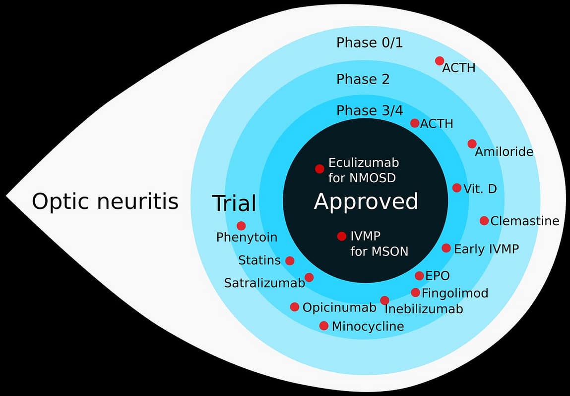 Optic Neuritis Steroid Treatment