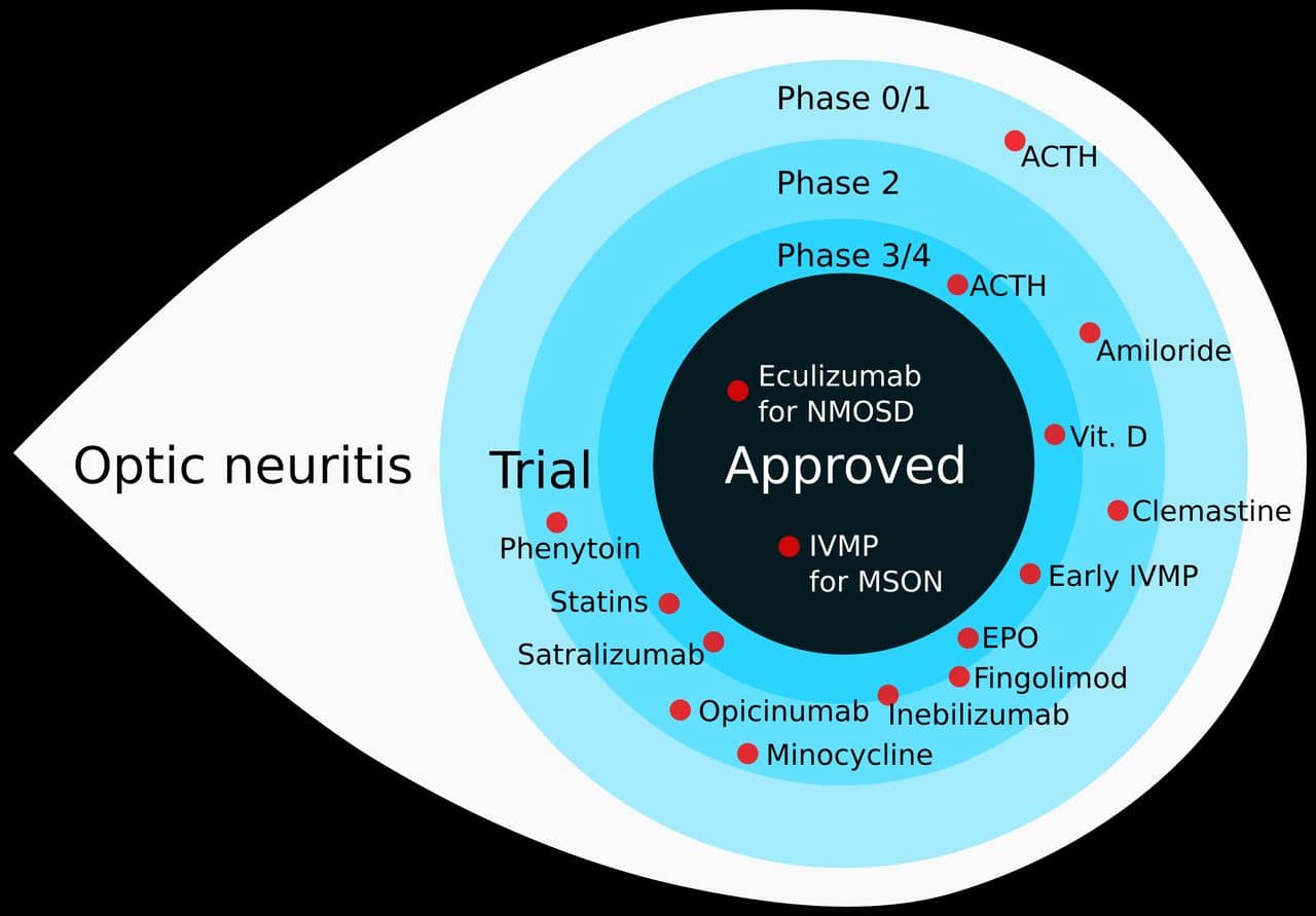 Optic Neuritis Steroid Treatment