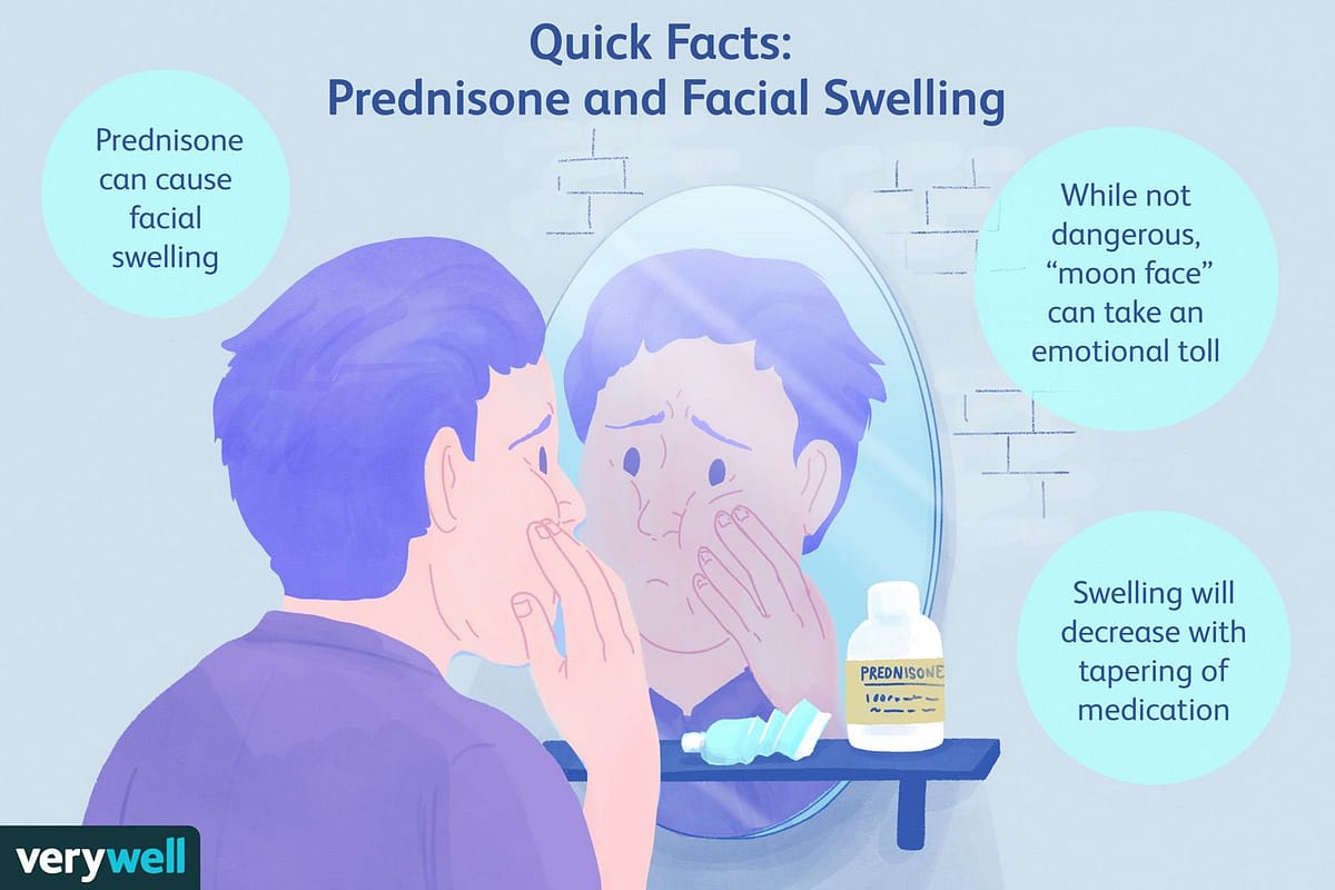 How To Reduce Steroid Moon Face