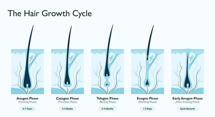 Steroid Causes Hair Loss