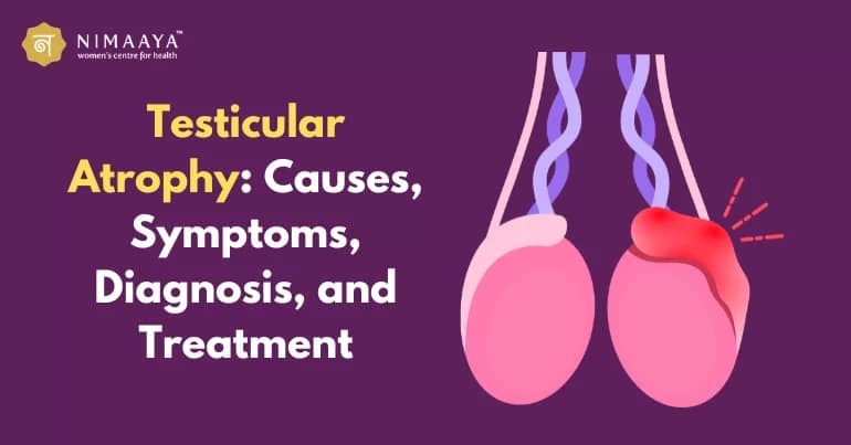 Steroids Testicular Atrophy